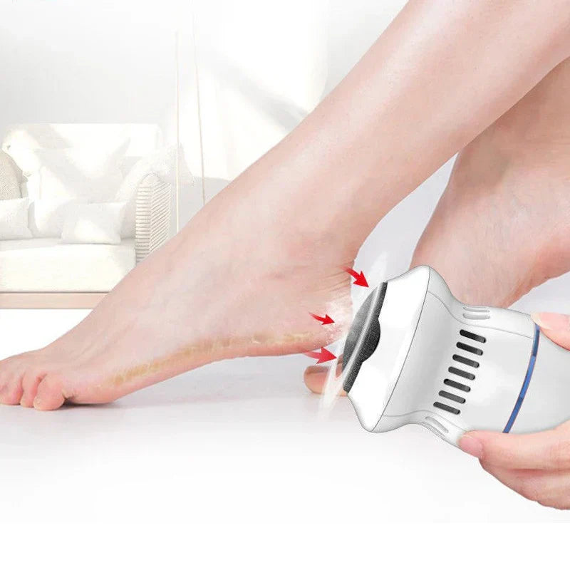 Professional Electric Callus Remover-Homelova