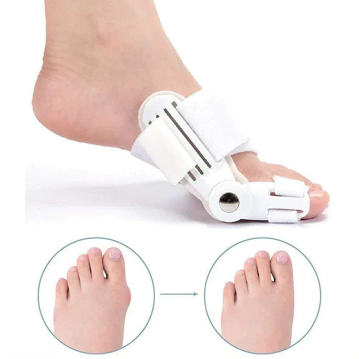 Hallux Valgus Correction Splint (1 Pair)-Homelova